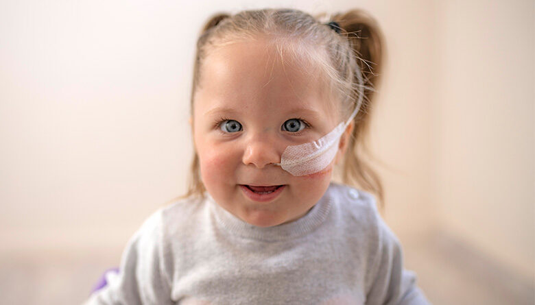 Three year old Pippa with her feeding tube in.